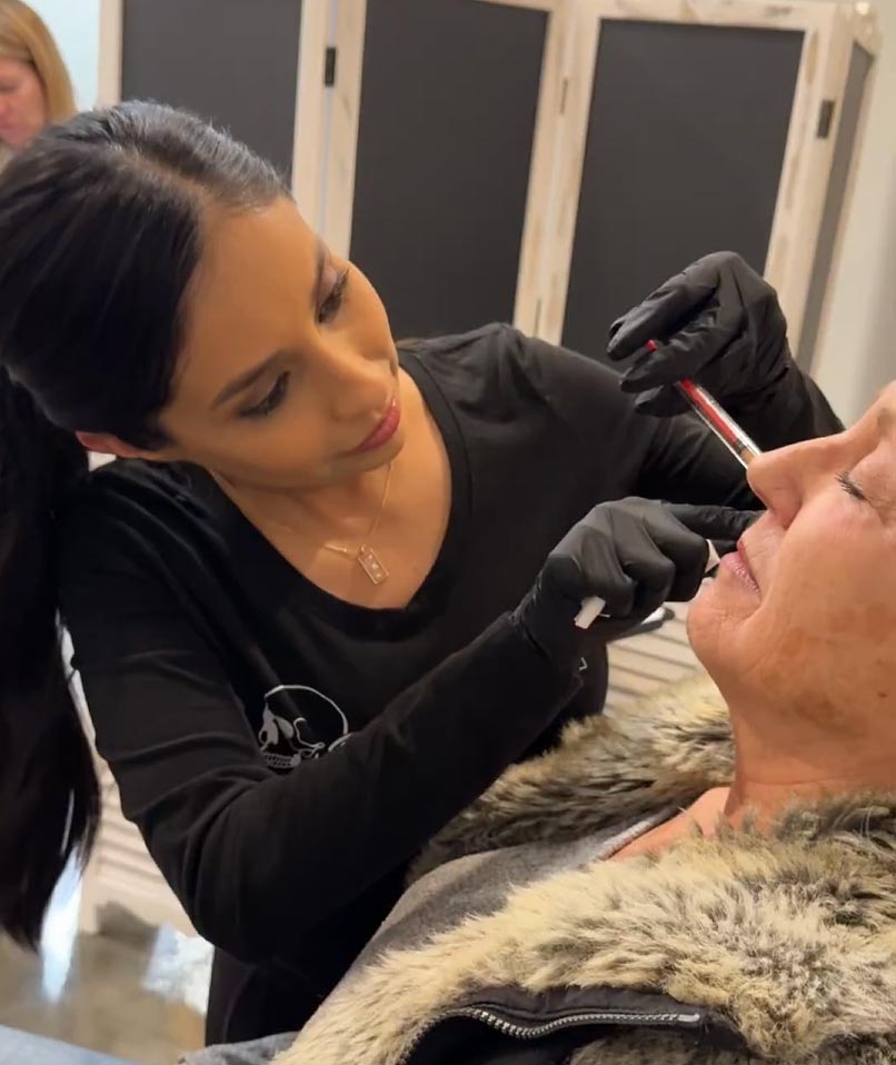EZ Gel injectable treatment being performed