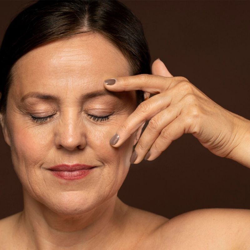 How to Prepare for Wrinkle-Relaxer Injections
