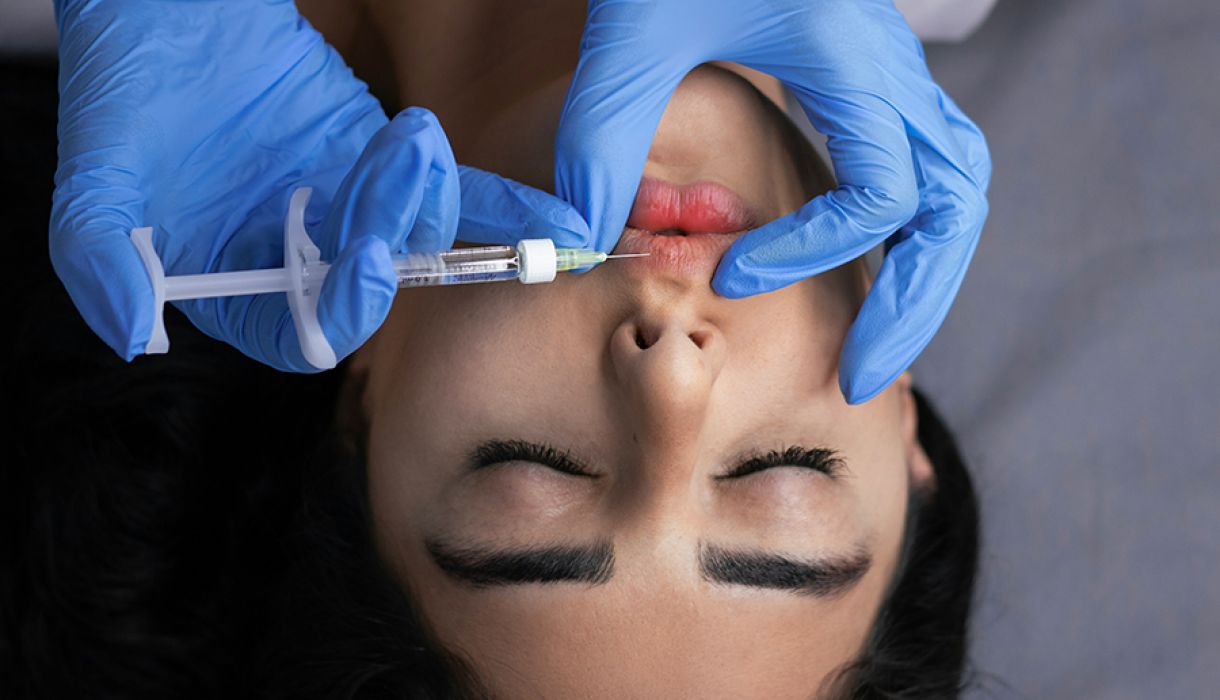Lip Filler