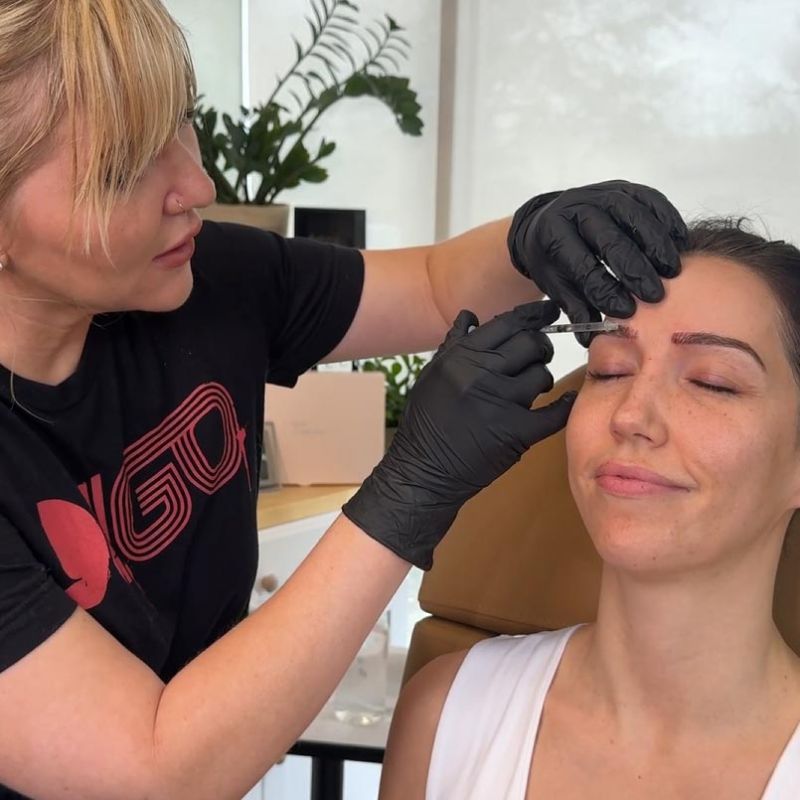 PRF injectable treatment above eyebrow area