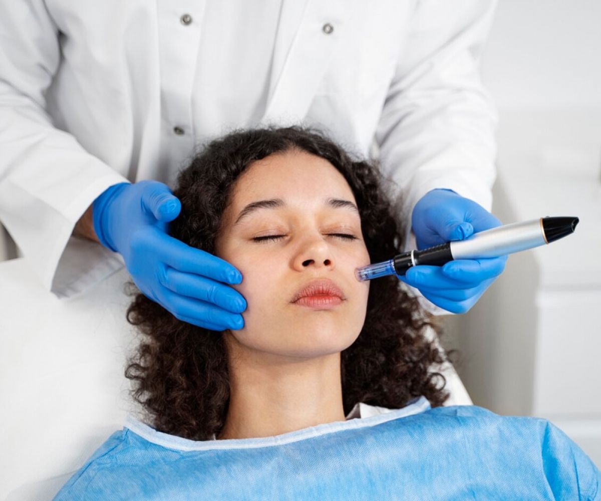 What to Expect During PRF Microneedling, Blood Draw and All
