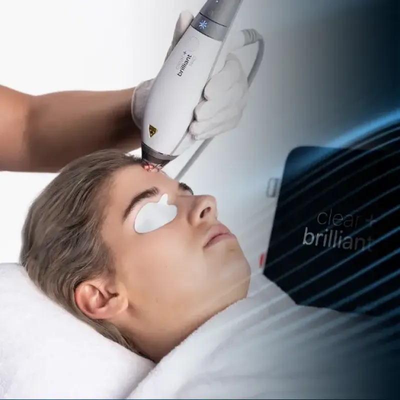 Clear and Brilliant laser treatment in clinical setting