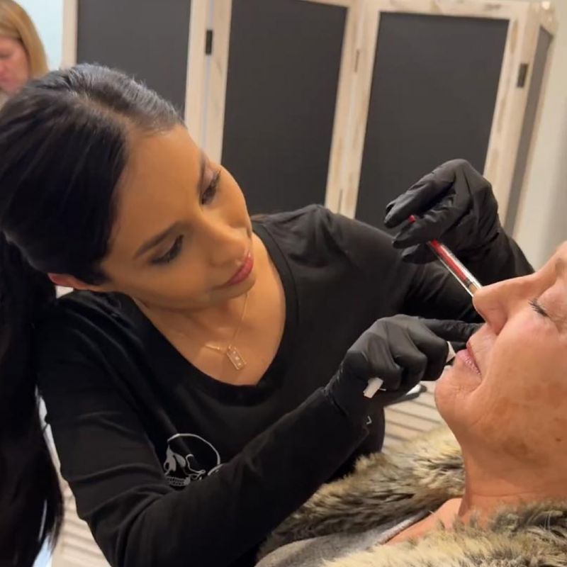 EZ Gel injectable treatment being performed