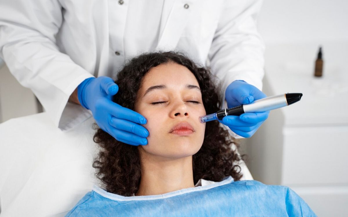 What to Expect During PRF Microneedling, Blood Draw and All