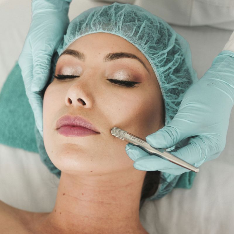 woman receiving a stem cell harvesting procedure using ACORN technology