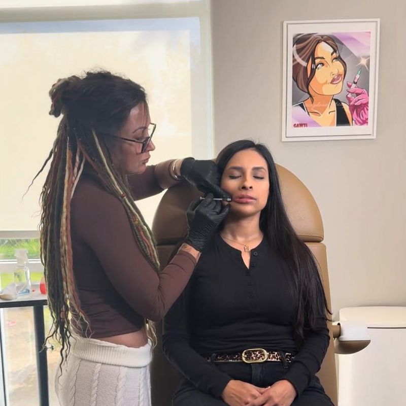 a woman receiving raidesse treatment to enhance facial volume