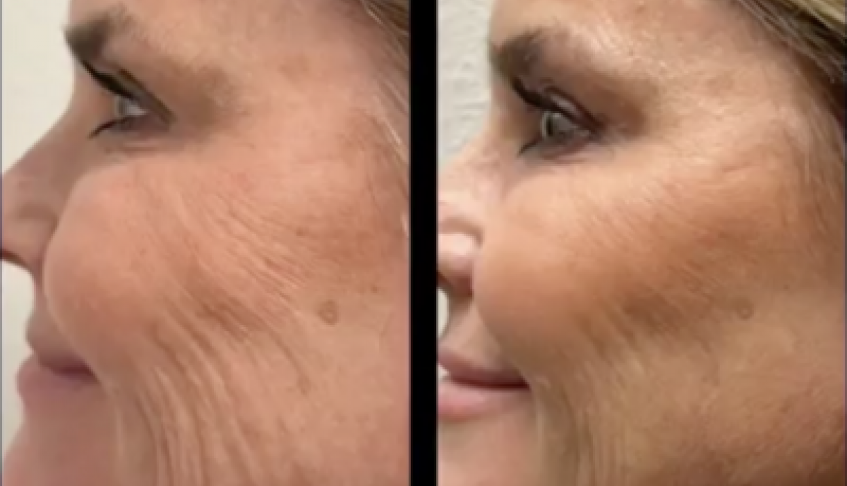 Anti-Aging Treatments