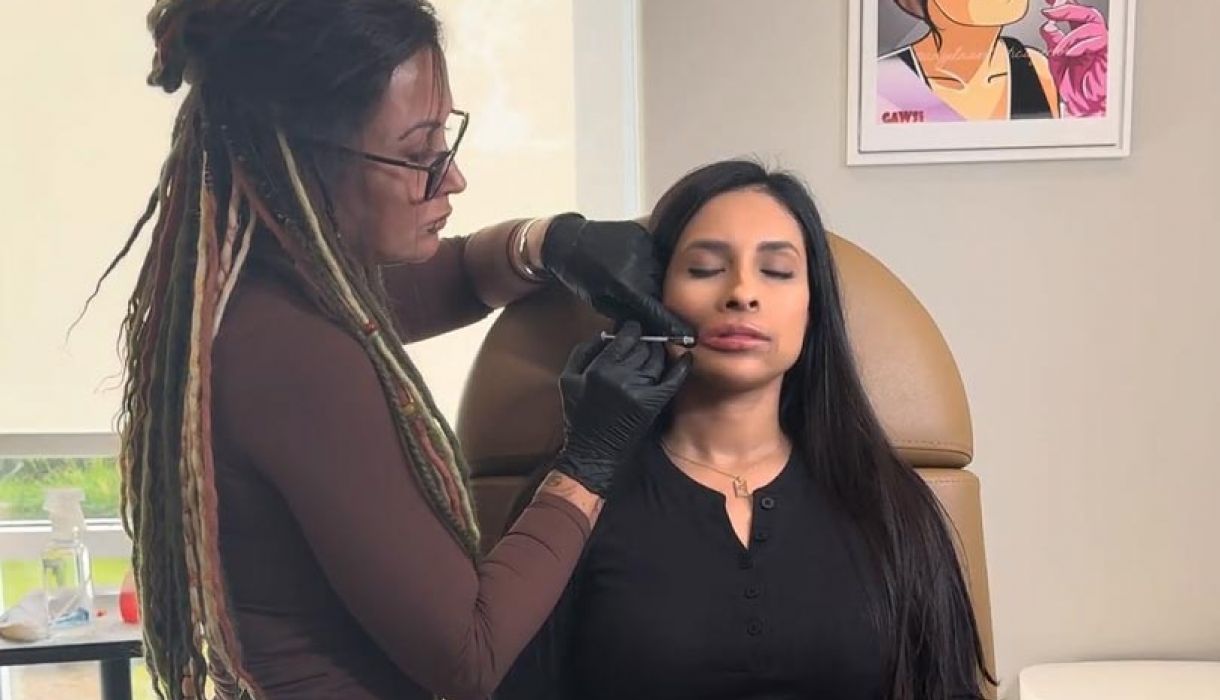a woman receiving raidesse treatment to enhance facial volume