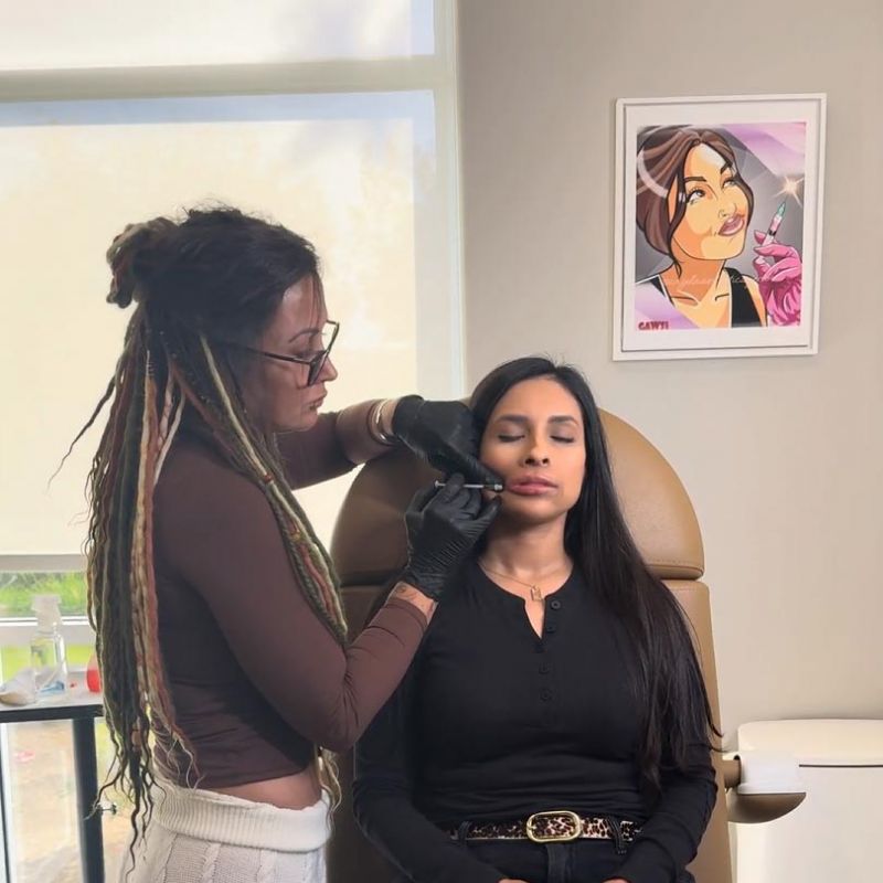 a woman receiving raidesse treatment to enhance facial volume